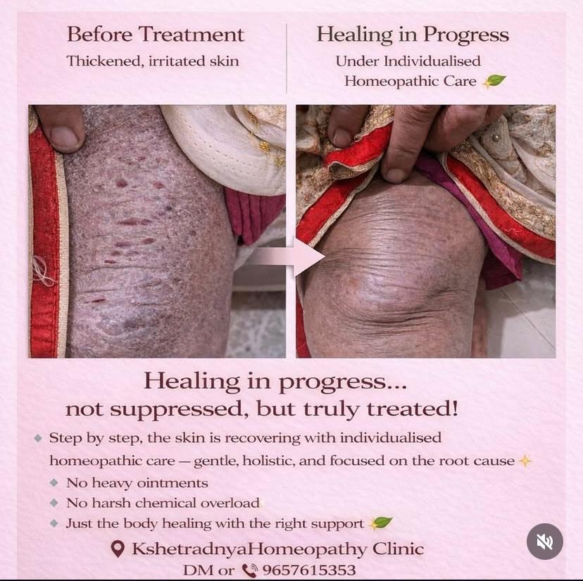 Healing