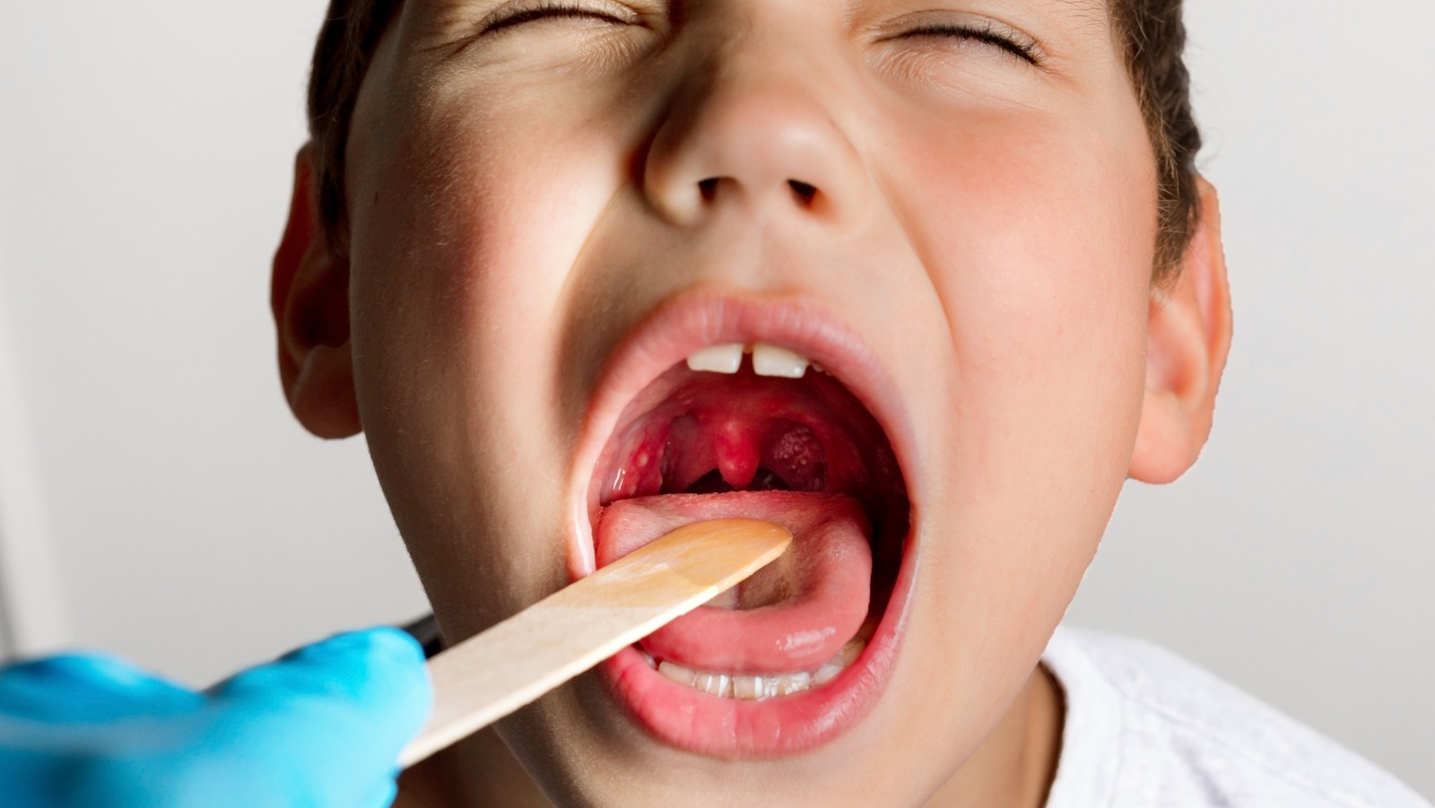 tonsils